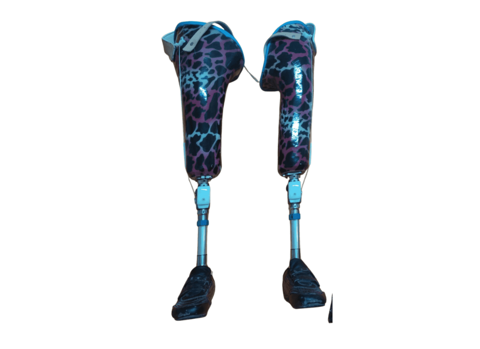 Lower Limb Prosthetics