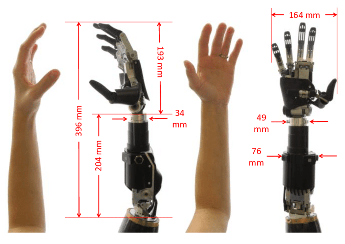 Lower Limb Prosthetics