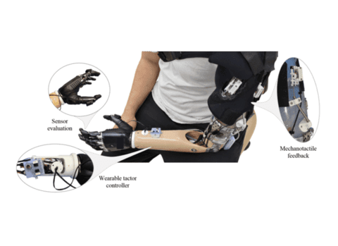 Lower Limb Prosthetics